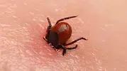 Kene şüphesiyle bir kişi daha hayatını kaybetti