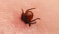 Sağlık Bakanlığından vücuda tutunan keneye çıplak elle dokunmayın uyarısı