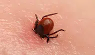 Kene şüphesiyle bir kişi daha hayatını kaybetti
