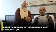 Nefes darlığının altından nadir aort yırtılması çıktı