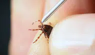 5 çocuk annesi kene ısırığından hayatını kaybetti