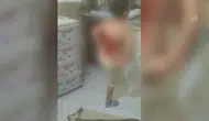 Arnavutköy’de bir çocuk akranlarınca kolonyayla yakıldı