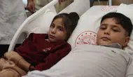 İki kardeşin kalbindeki delik aynı gün ameliyatsız kapatıldı