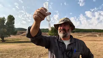 Akademisyenler Blastocystis mikroorganizmasının riskini araştırıyor