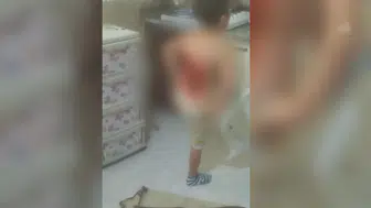 Arnavutköy’de bir çocuk akranlarınca kolonyayla yakıldı