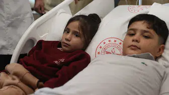 İki kardeşin kalbindeki delik aynı gün ameliyatsız kapatıldı