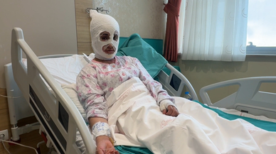 İftara hazırlık sırasında patlayan düdüklü tencere iki çocuk annesini hastanelik etti