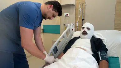 Hararet yapan araca acele müdahale ikinci derece yanığa neden oldu