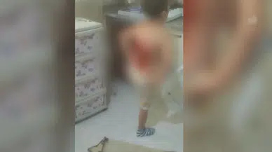 Arnavutköy’de bir çocuk akranlarınca kolonyayla yakıldı