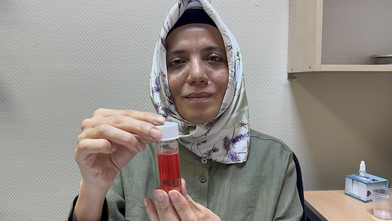 SDÜ Göz Bankası, 2 yılda 100'den fazla hastaya ışık oldu