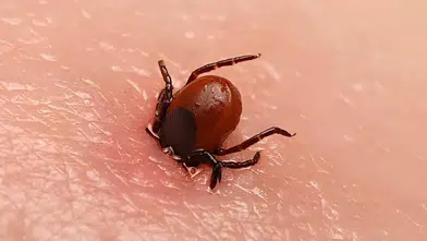 Kene şüphesiyle bir kişi daha hayatını kaybetti