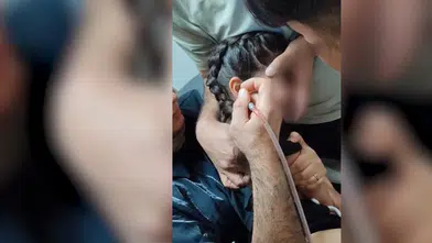 Kulak ağrısı şikayetiyle hastaneye gitti, kulağından kene çıkarıldı