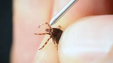 5 çocuk annesi kene ısırığından hayatını kaybetti