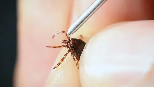5 çocuk annesi kene ısırığından hayatını kaybetti
